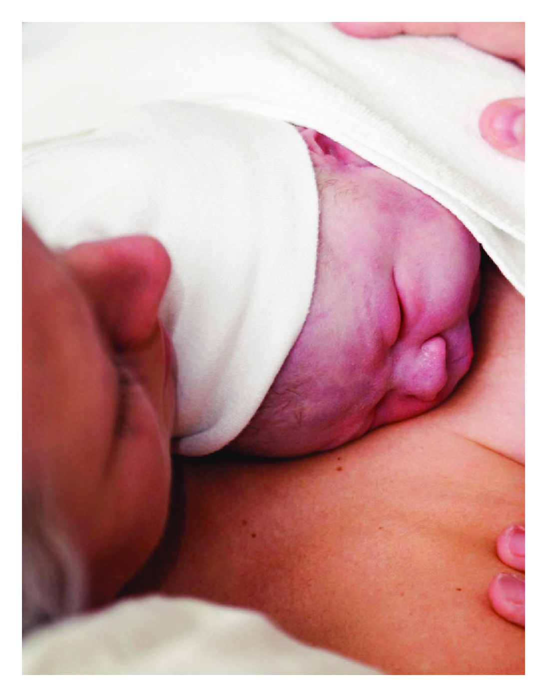 Implementing Skin-To-Skin Contact at Birth Using the Iowa Model: Applying Evidence to Practice