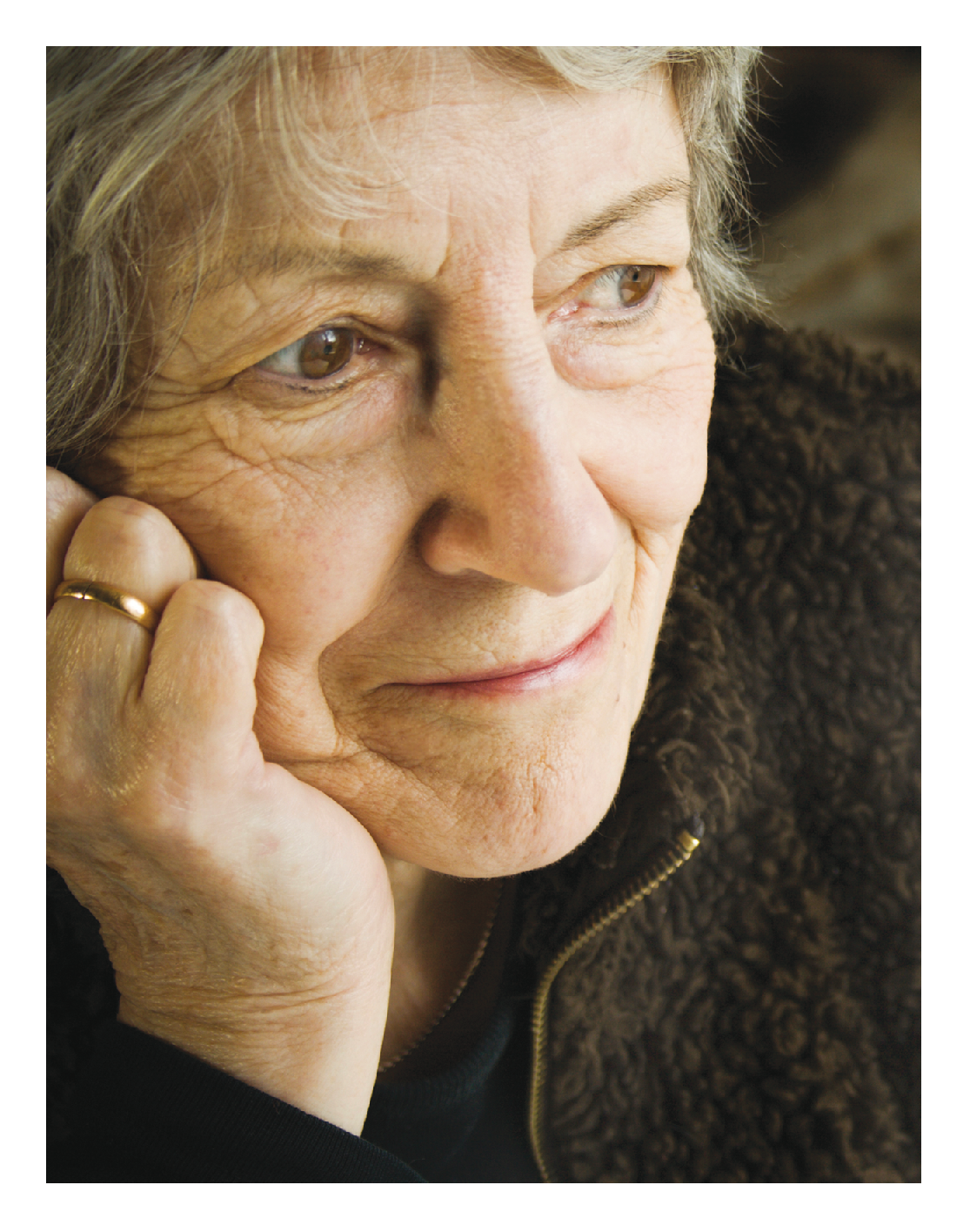Alzheimer Disease in Women: A Clinical and Genetics Perspective
