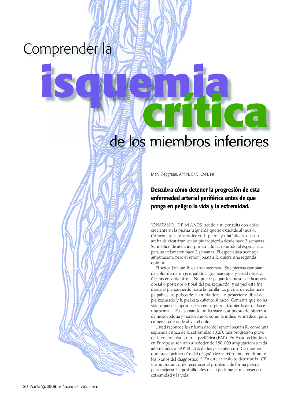 Comprender la isquemia crÃ­tica de los miembros inferiores