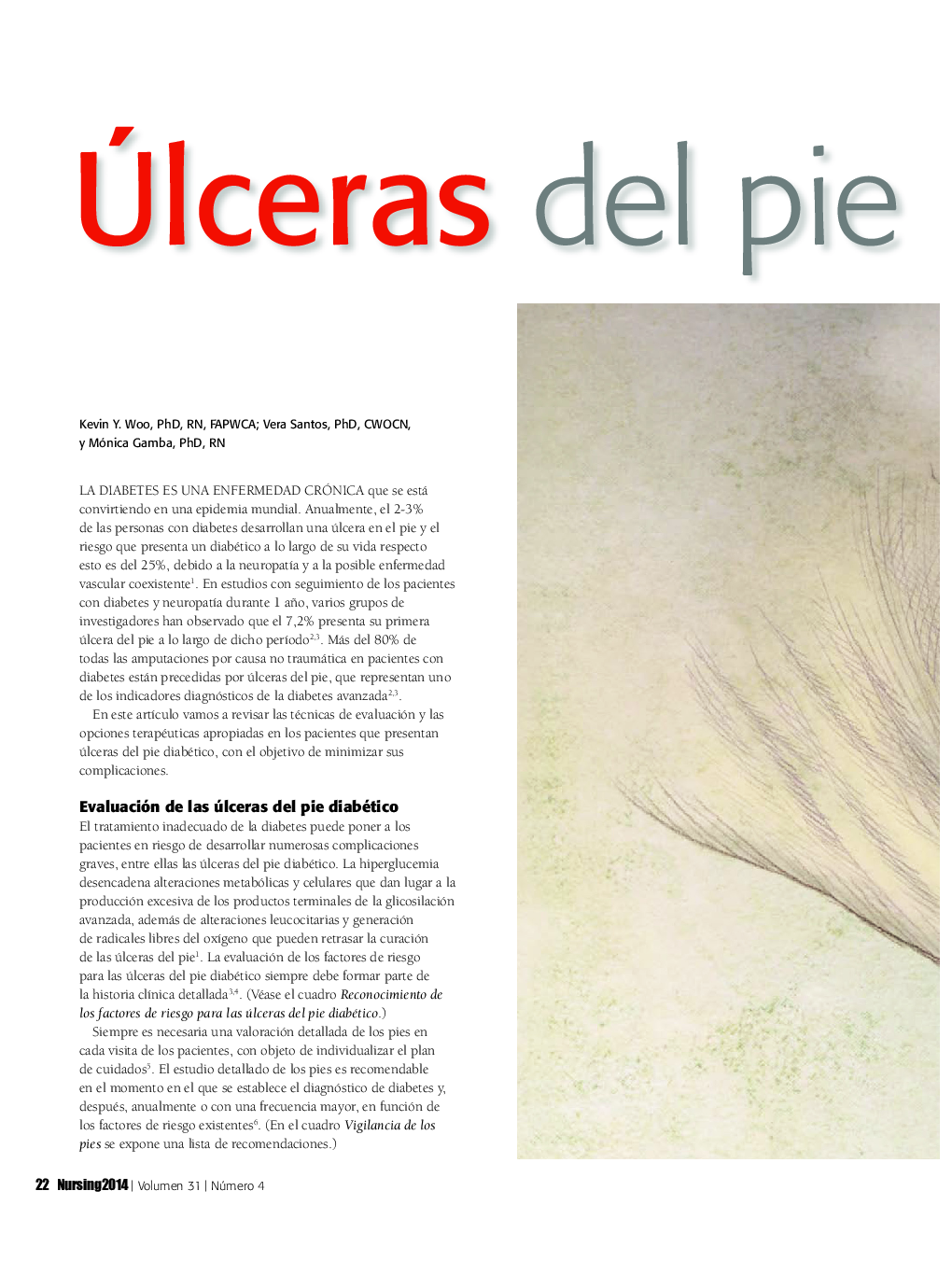 عکس صفحه اول مقاله: Ãlceras del pie diabético Ãlceras del pie diabético