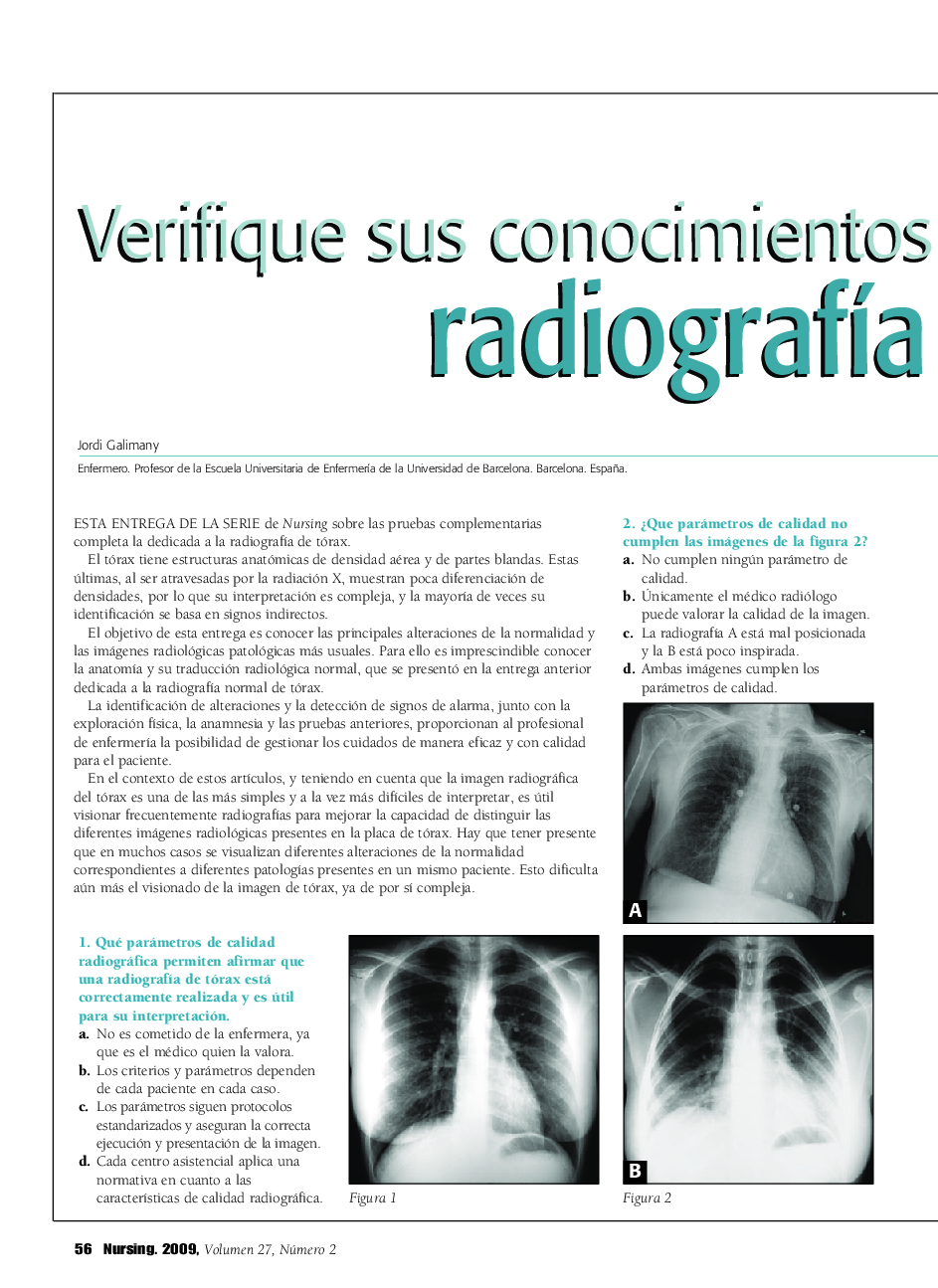 Verifique sus conocimientos sobre: radiografÃ­a de tórax (2)