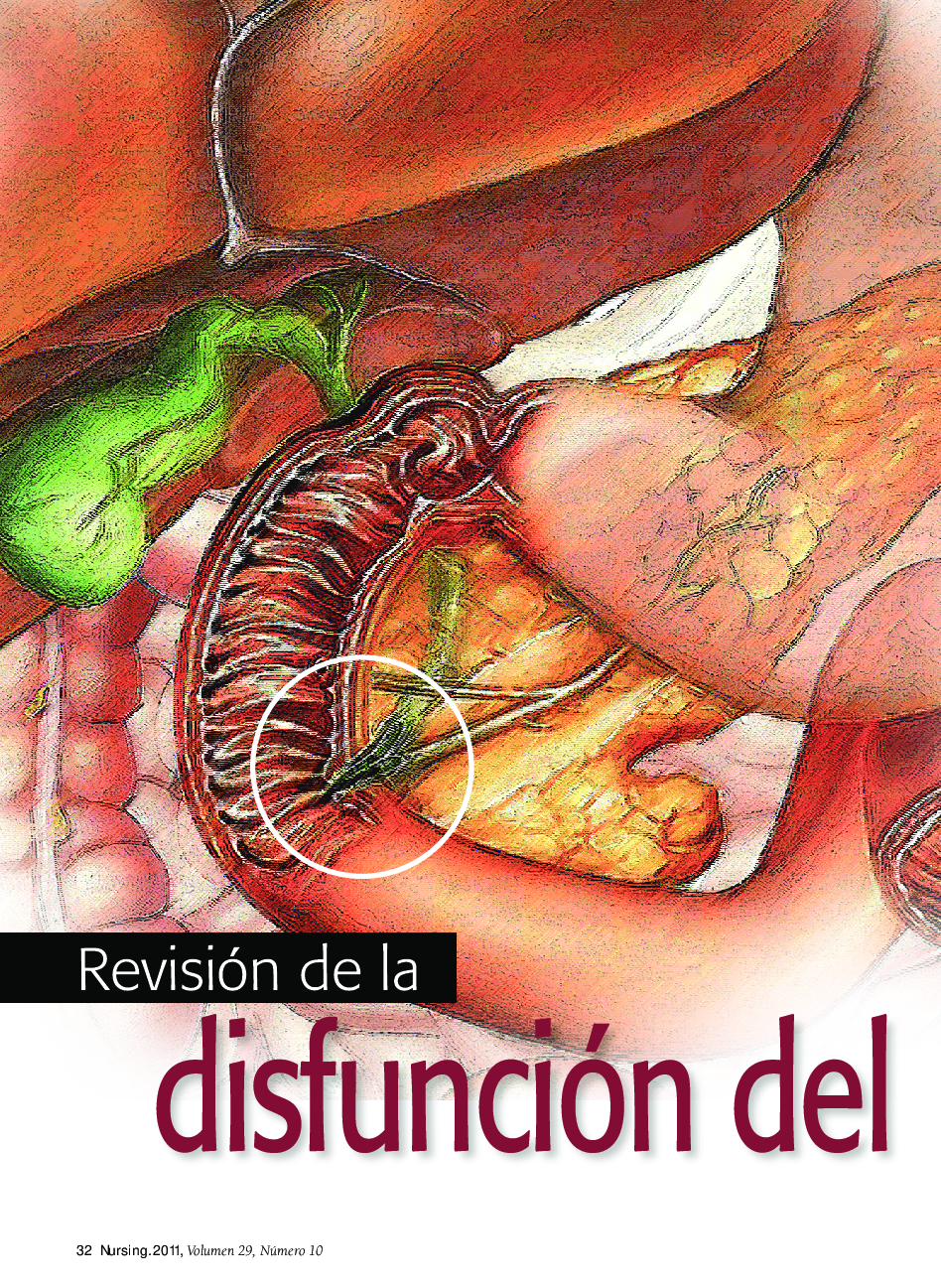 عکس صفحه اول مقاله: Revisión de la disfunción delesfÃnter de Oddi Revisión de la disfunción delesfÃnter de Oddi