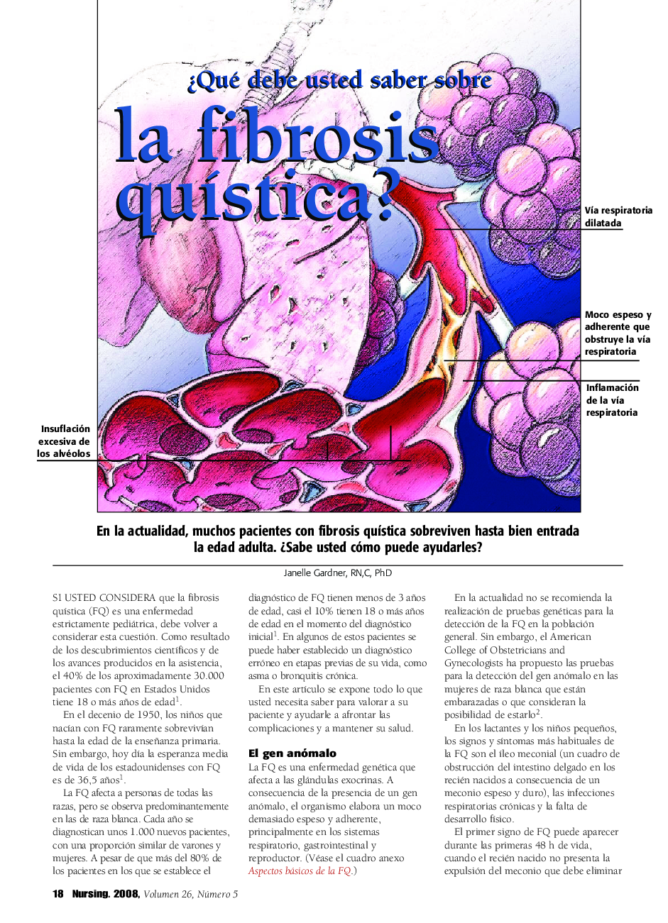 عکس صفحه اول مقاله: ¿Qué debe ustted saber sobre la fibrosis quÃstica? ¿Qué debe ustted saber sobre la fibrosis quÃstica?