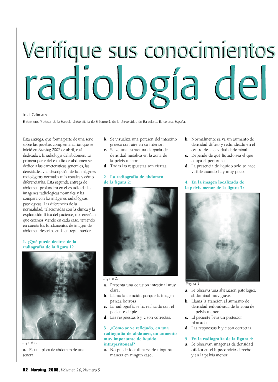 عکس صفحه اول مقاله: Verifique sus conocimientos sobre radiologÃa del abdomen (II) Verifique sus conocimientos sobre radiologÃa del abdomen (II)