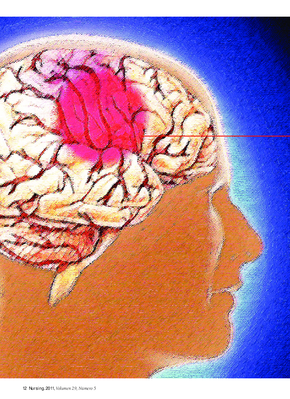 Respuesta activa frente al accidente cerebrovascular hemorrágico
