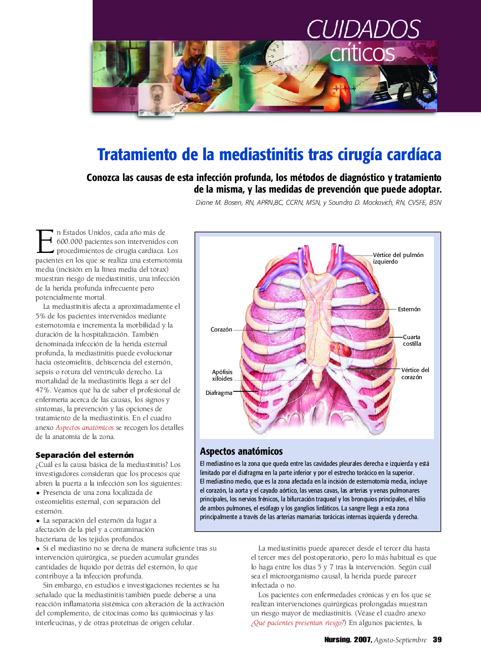 عکس صفحه اول مقاله: Tratamiento de la mediastinitis tras cirugÃa cardÃaca Tratamiento de la mediastinitis tras cirugÃa cardÃaca