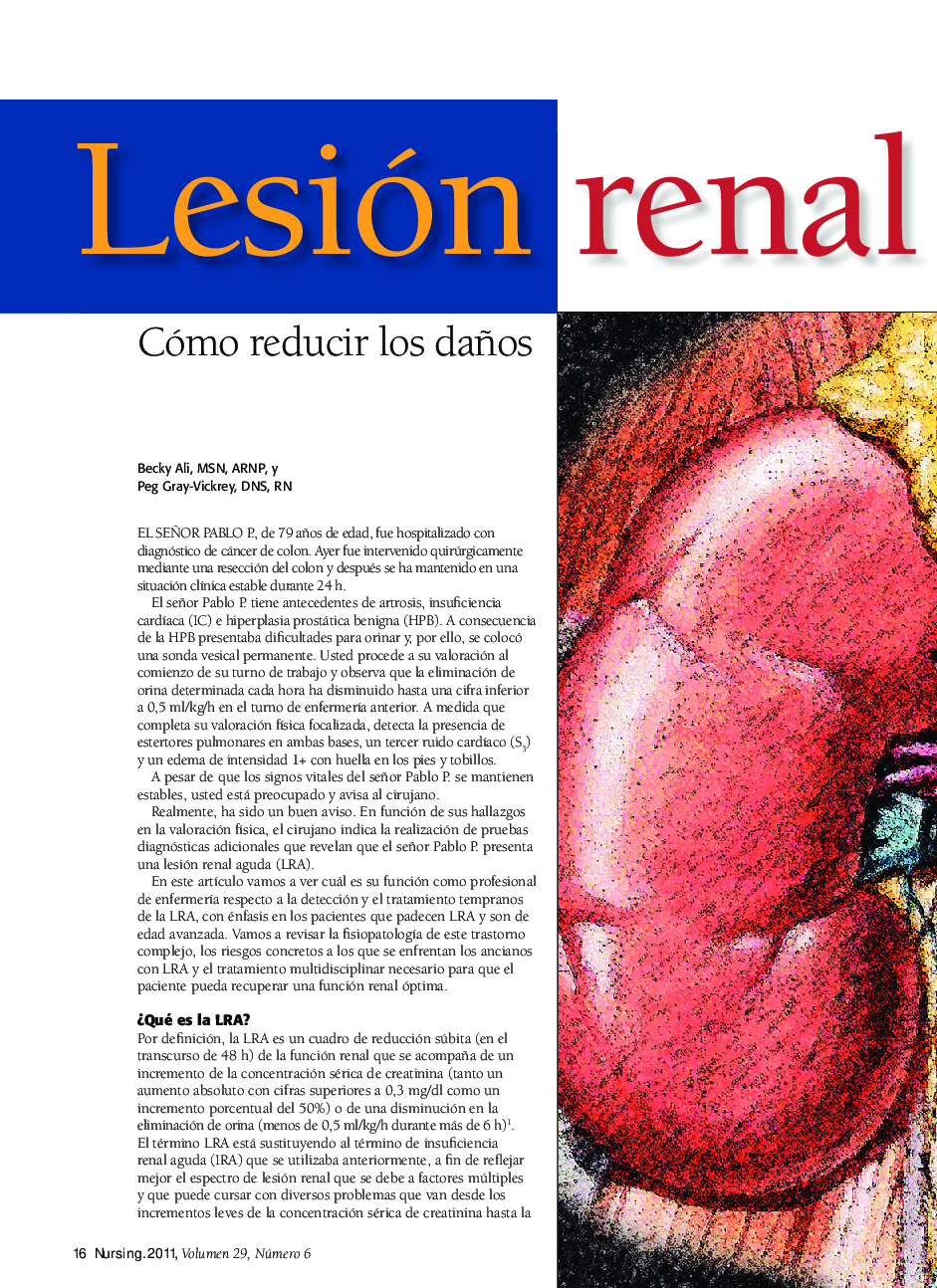 عکس صفحه اول مقاله: Lesión renal aguda: Cómo reducir los daños Lesión renal aguda: Cómo reducir los daños