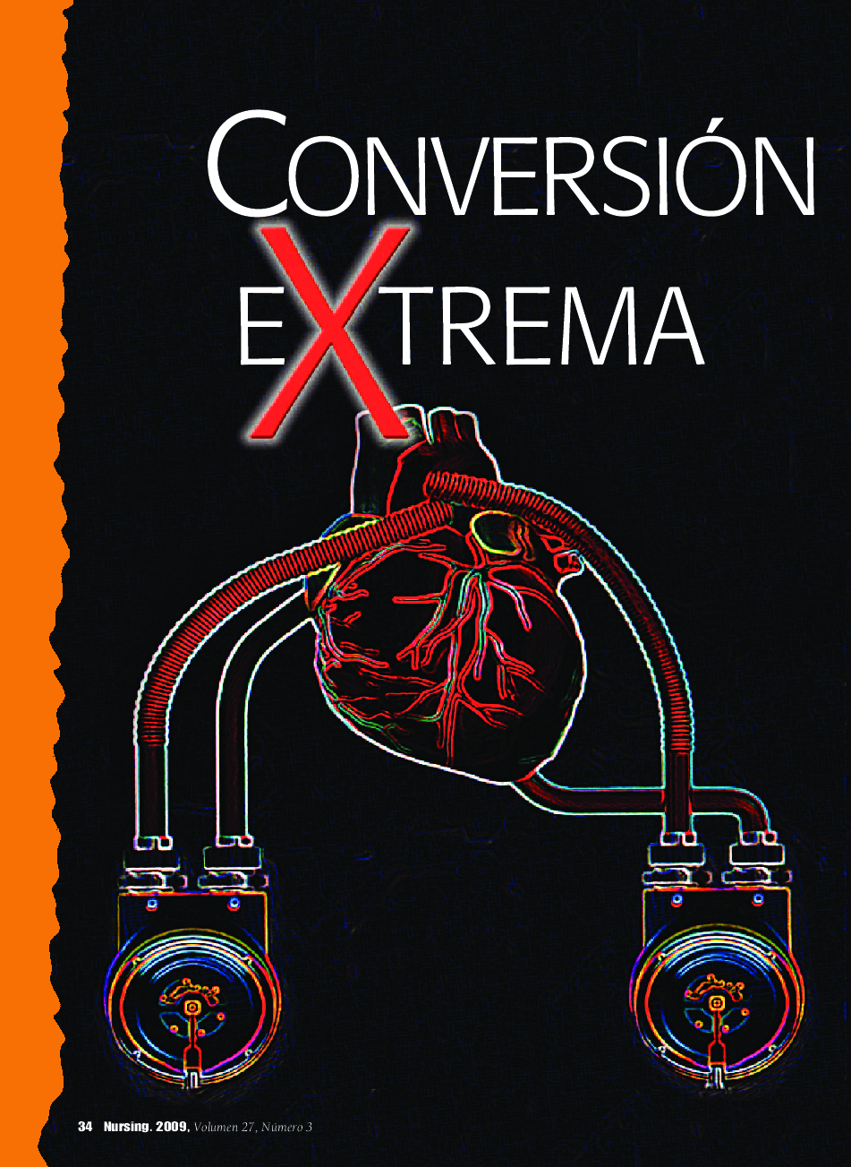عکس صفحه اول مقاله: Conversión cardÃaca extrema Conversión cardÃaca extrema