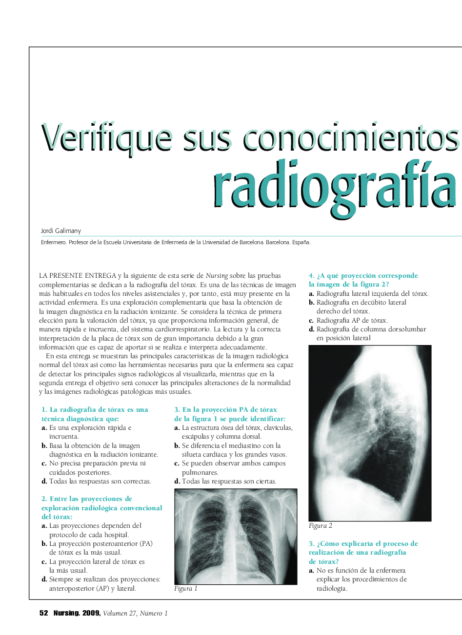 عکس صفحه اول مقاله: Verifique sus conocimientos sobre radiografÃa de tórax (1) Verifique sus conocimientos sobre radiografÃa de tórax (1)