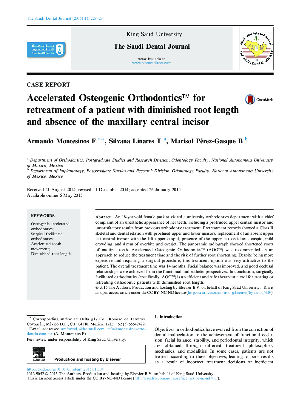 Accelerated Osteogenic Orthodontics™ for retreatment of a patient with diminished root length and absence of the maxillary central incisor 