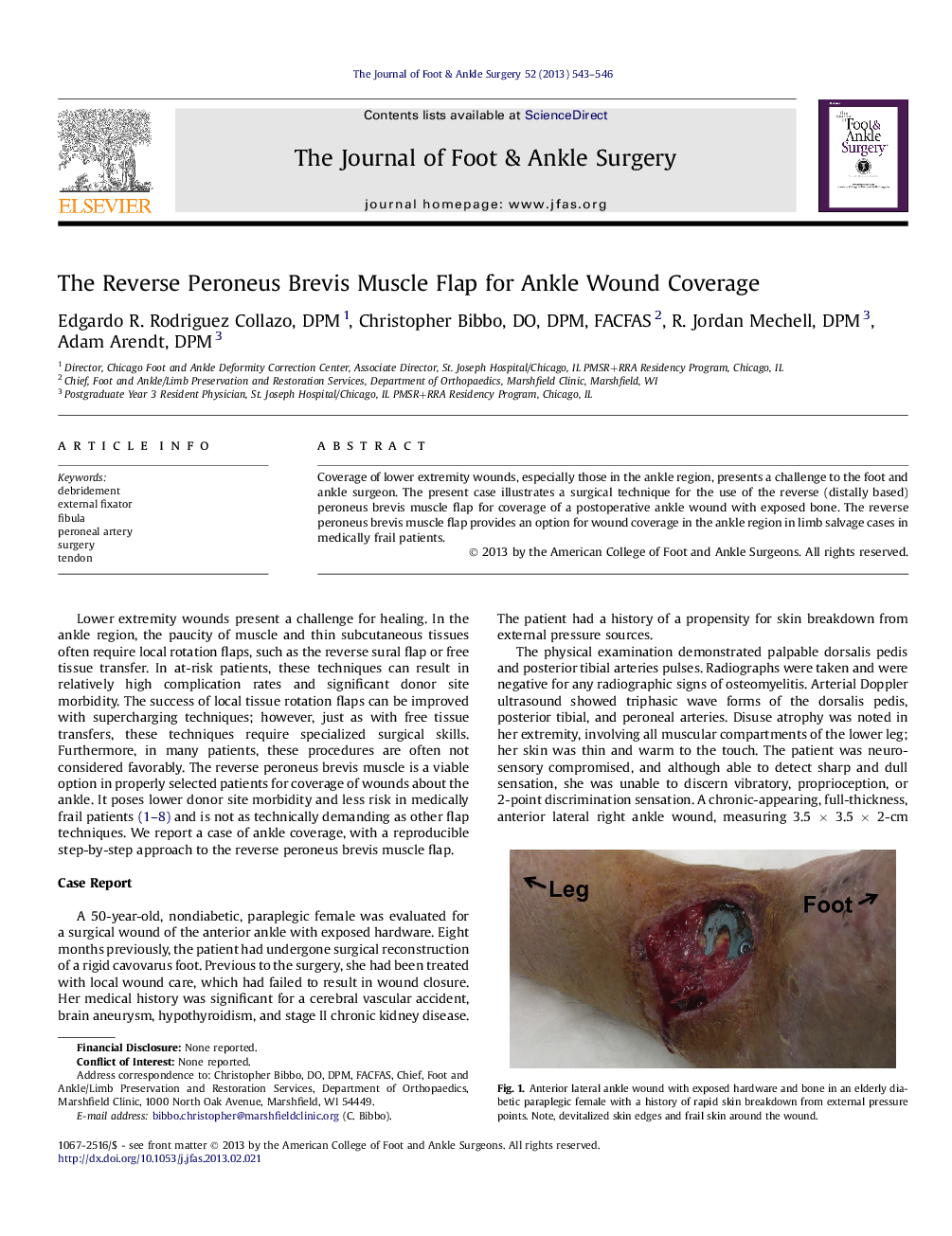 The Reverse Peroneus Brevis Muscle Flap for Ankle Wound Coverage 