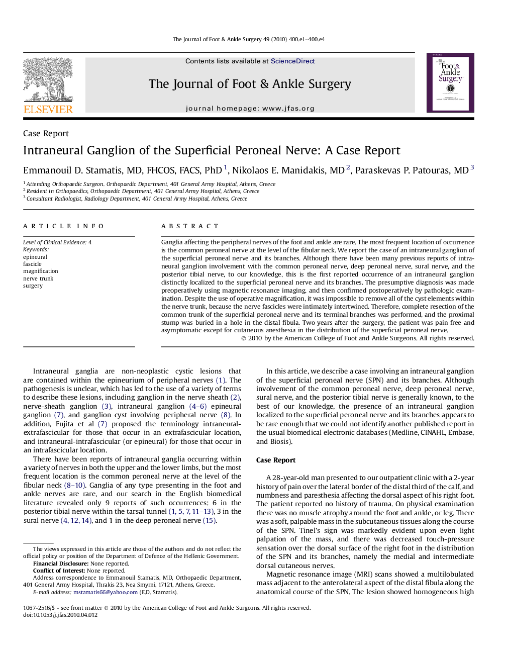 Intraneural Ganglion of the Superficial Peroneal Nerve: A Case Report