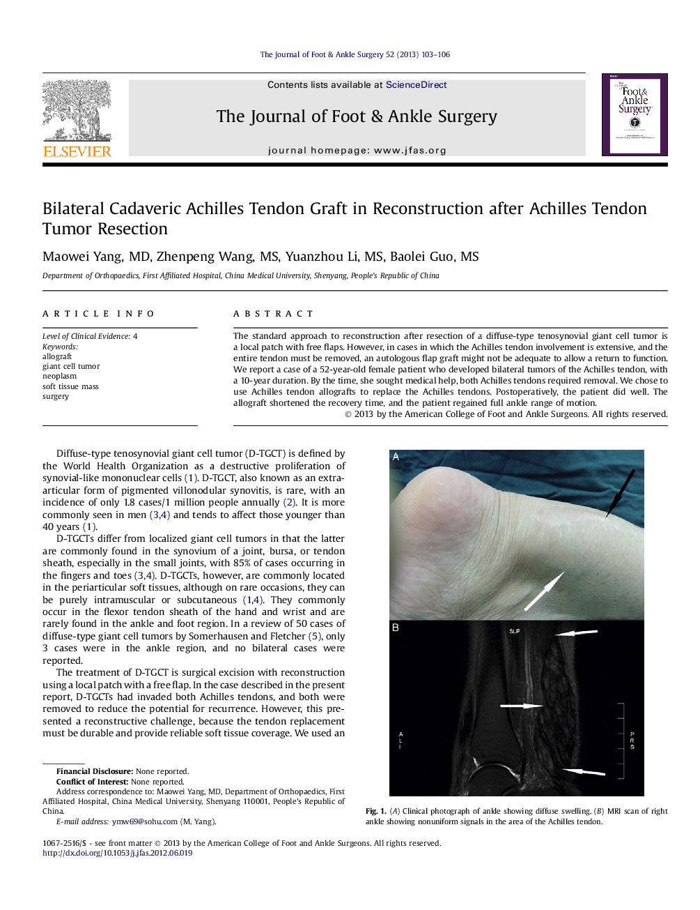 Bilateral Cadaveric Achilles Tendon Graft in Reconstruction after Achilles Tendon Tumor Resection 