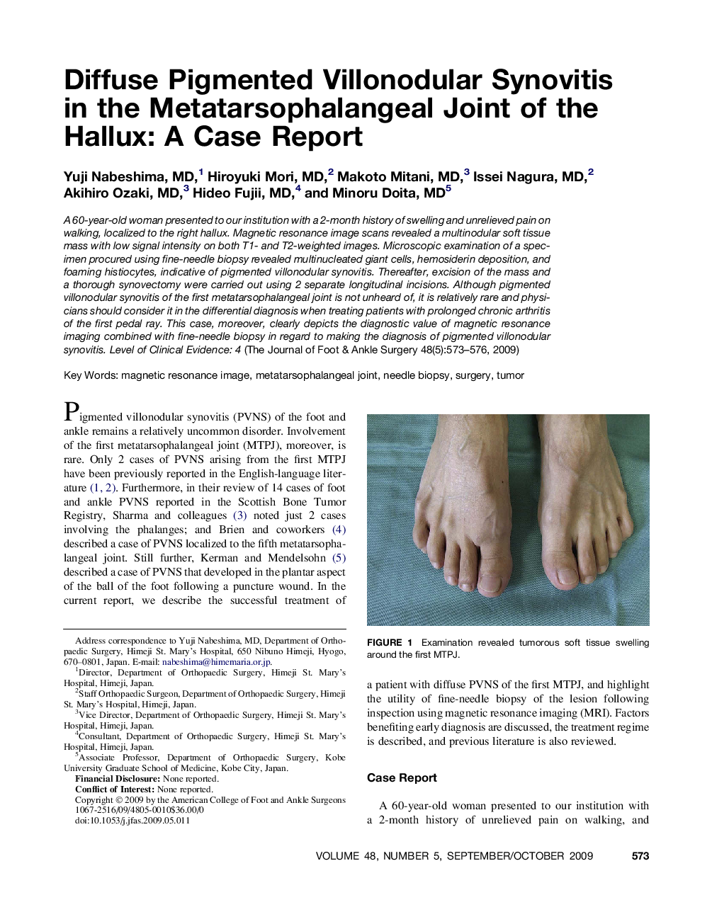 Diffuse Pigmented Villonodular Synovitis in the Metatarsophalangeal Joint of the Hallux: A Case Report