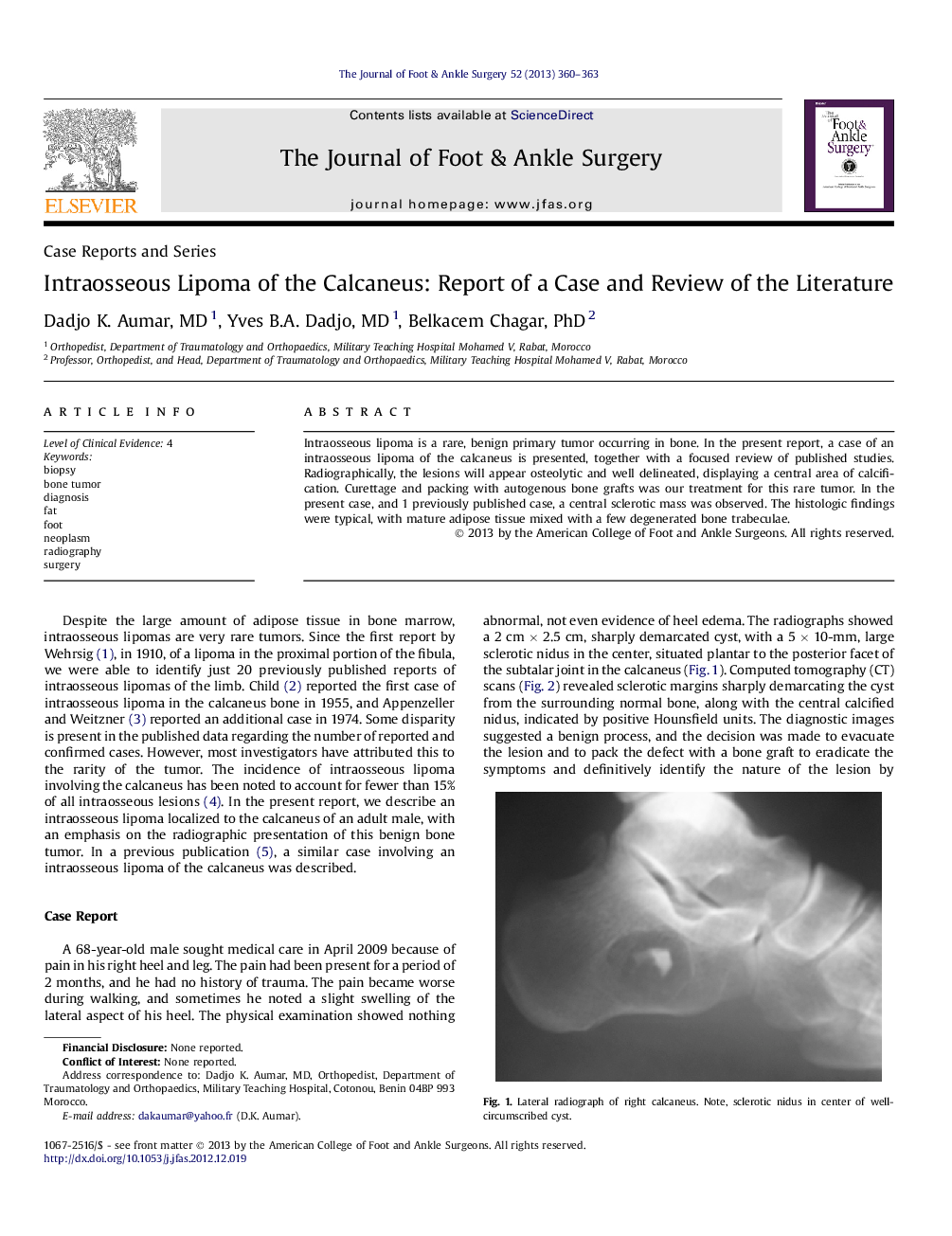 Intraosseous Lipoma of the Calcaneus: Report of a Case and Review of the Literature 