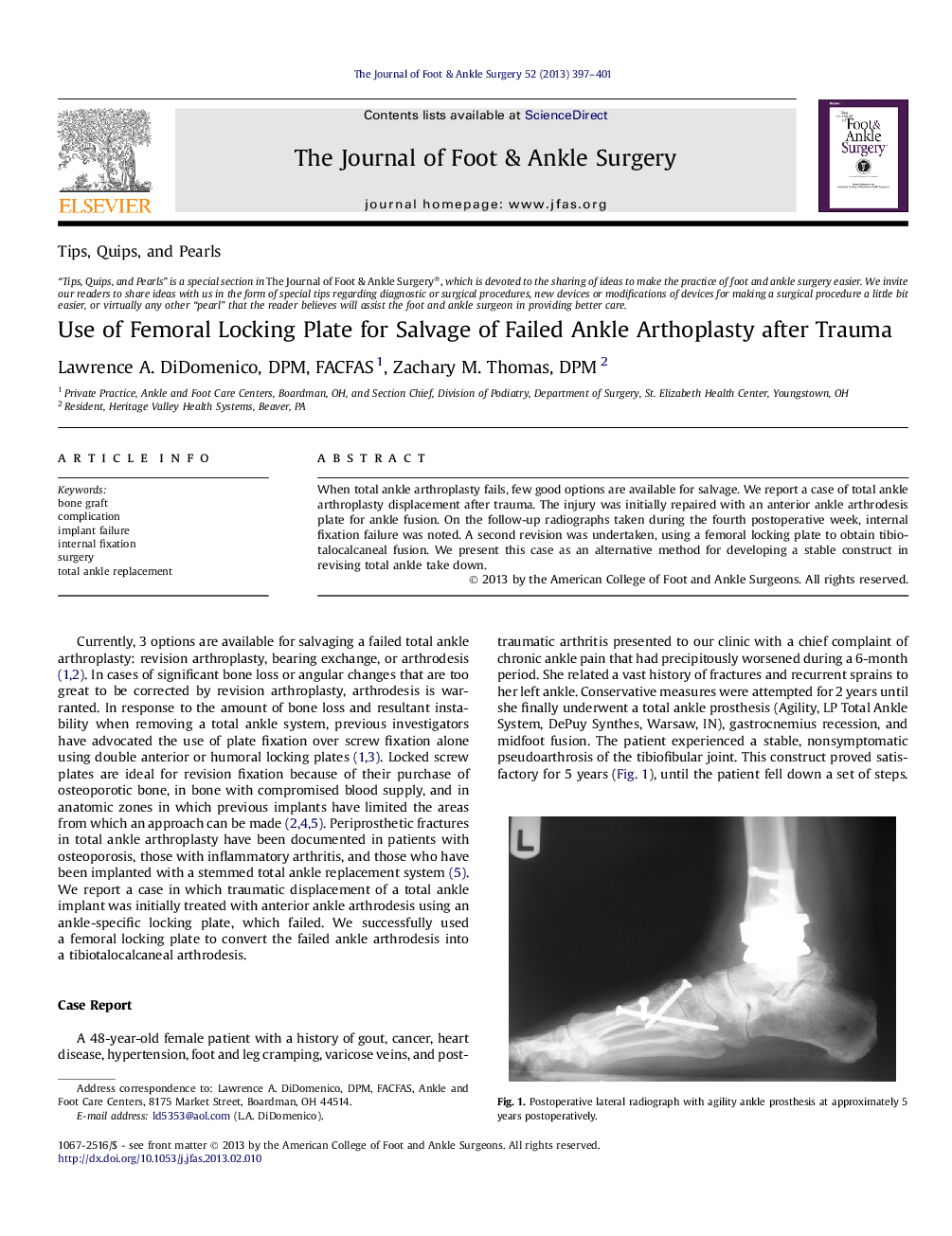 Use of Femoral Locking Plate for Salvage of Failed Ankle Arthoplasty after Trauma