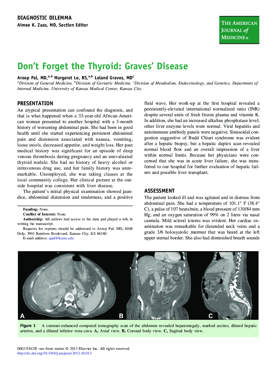 Don't Forget the Thyroid: Graves' Disease