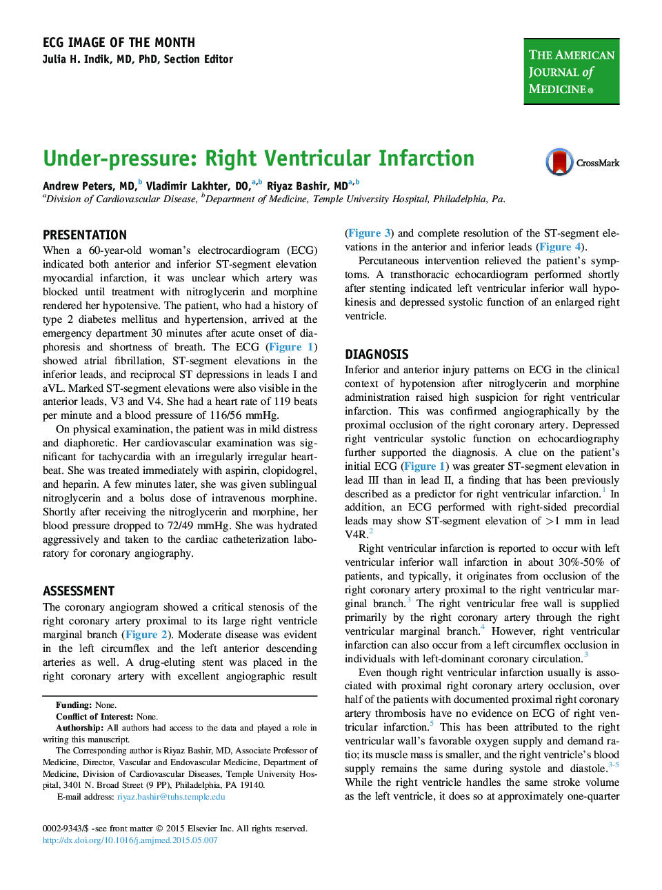 Under-pressure: Right Ventricular Infarction