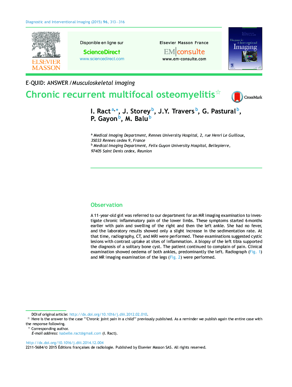 Chronic recurrent multifocal osteomyelitis