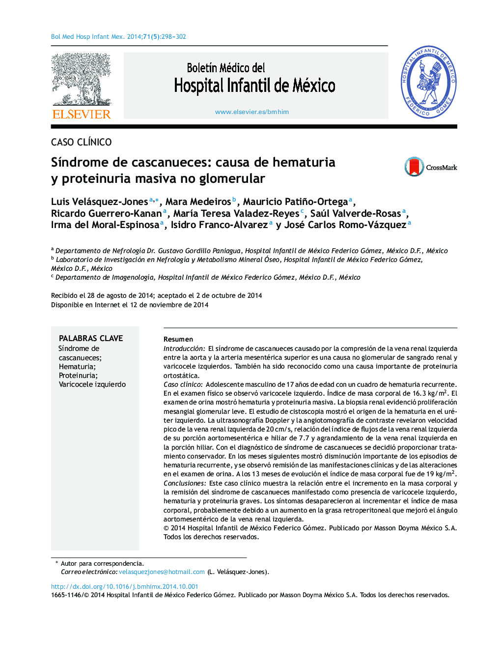 Síndrome de cascanueces: causa de hematuria y proteinuria masiva no glomerular