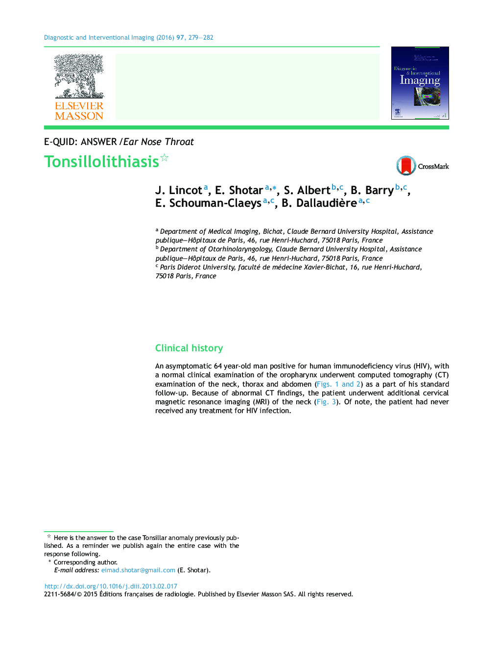 Tonsillolithiasis