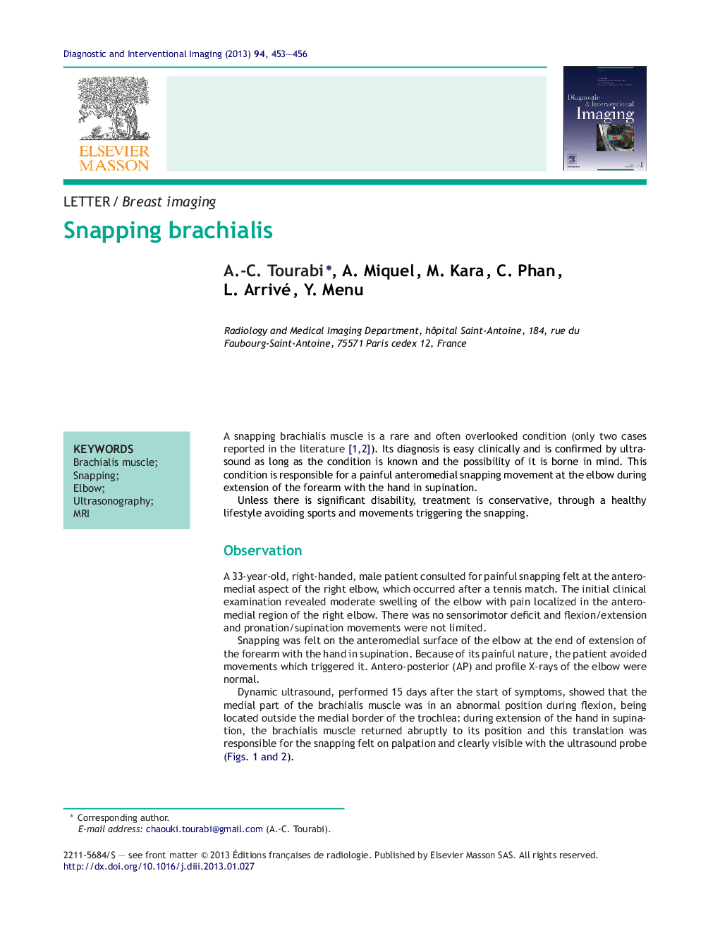 Snapping brachialis