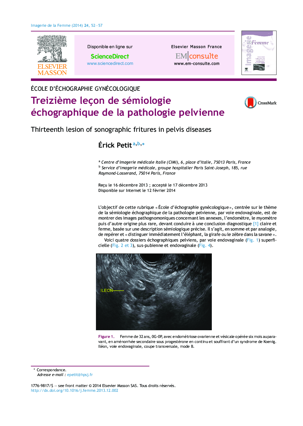 عکس صفحه اول مقاله: Treizième leçon de sémiologie échographique de la pathologie pelvienne Treizième leçon de sémiologie échographique de la pathologie pelvienne