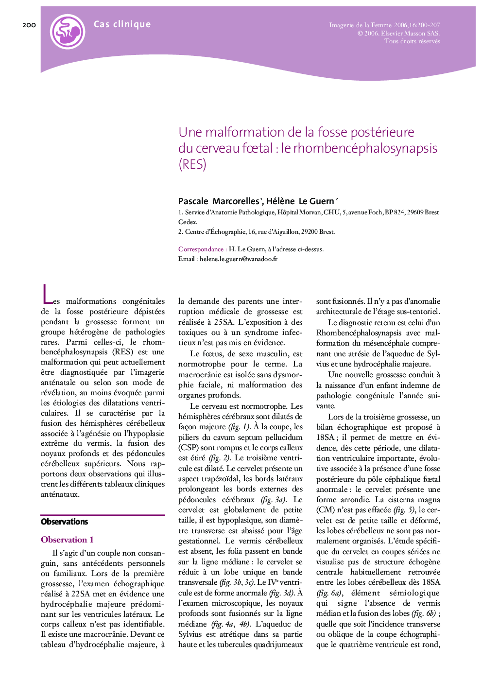 Une malformation de la fosse postérieure du cerveau fÅtal: le rhombencéphalosynapsis (RES)