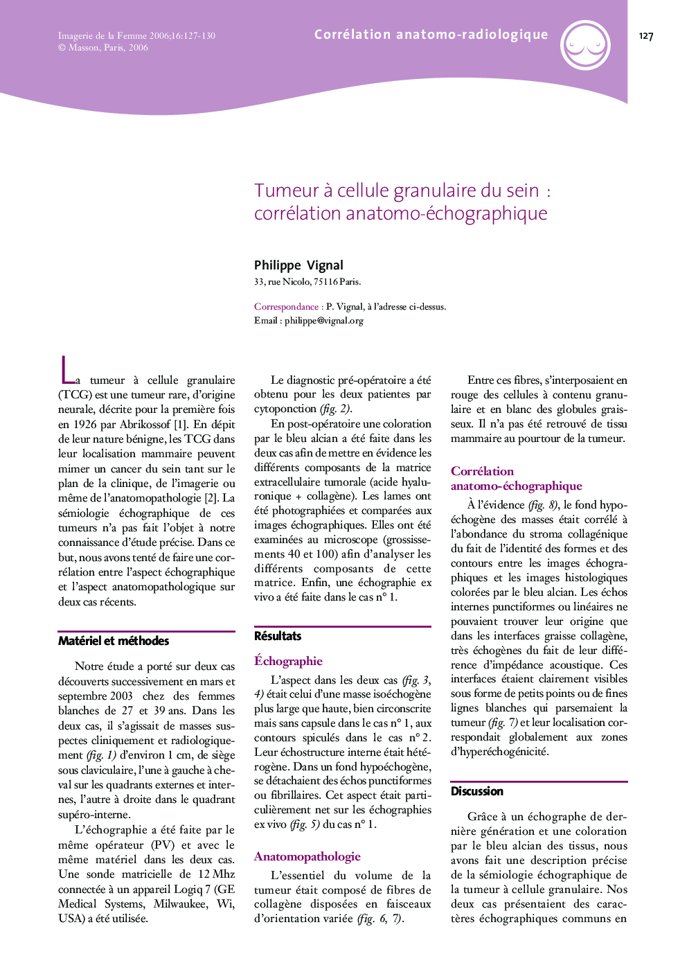 Tumeur Ã  cellule granulaire du sein : corrélation anatomo-échographique