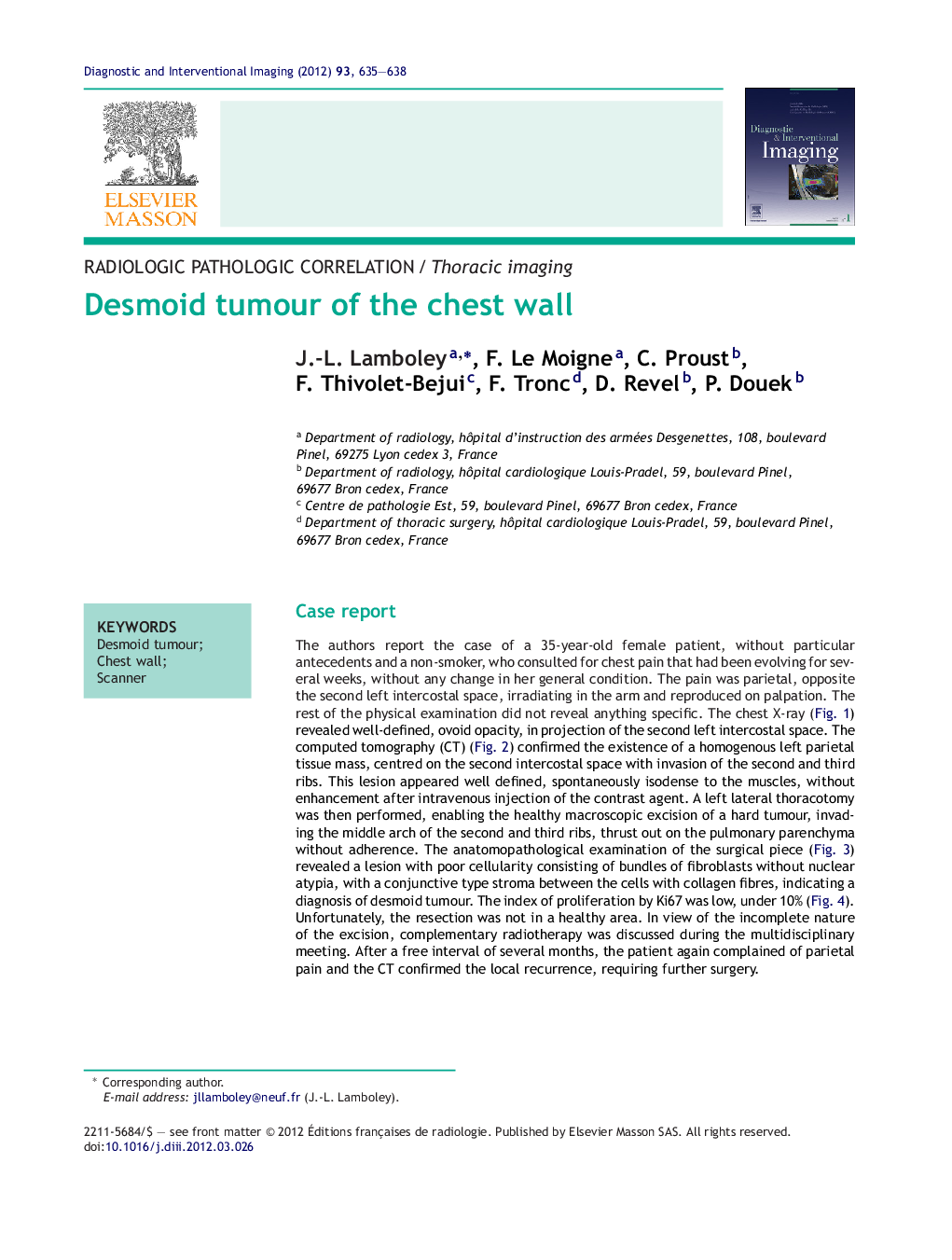 Desmoid tumour of the chest wall