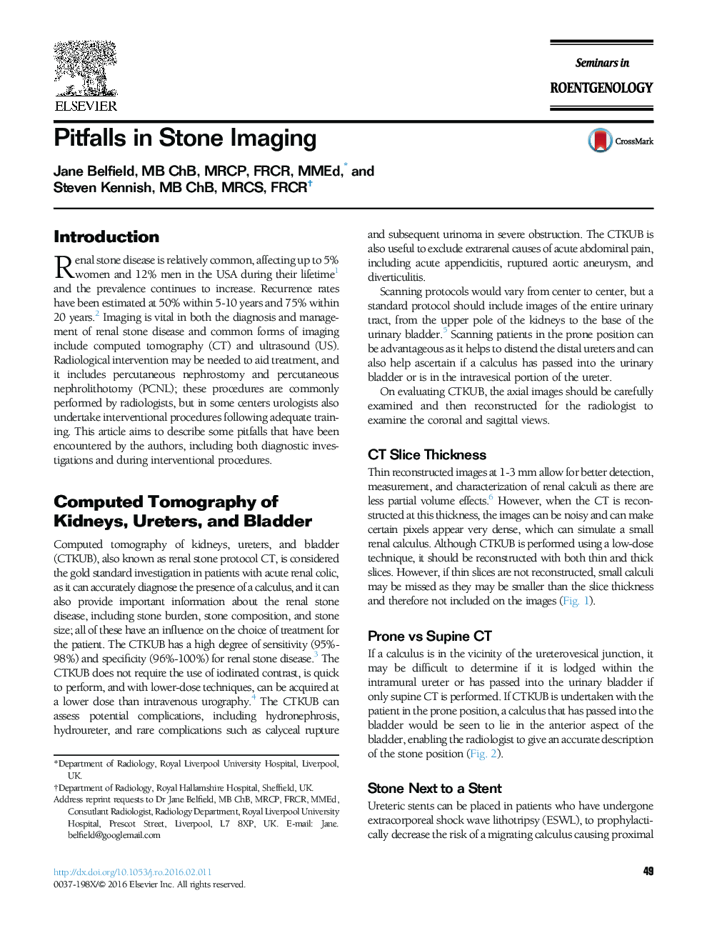 Pitfalls in Stone Imaging