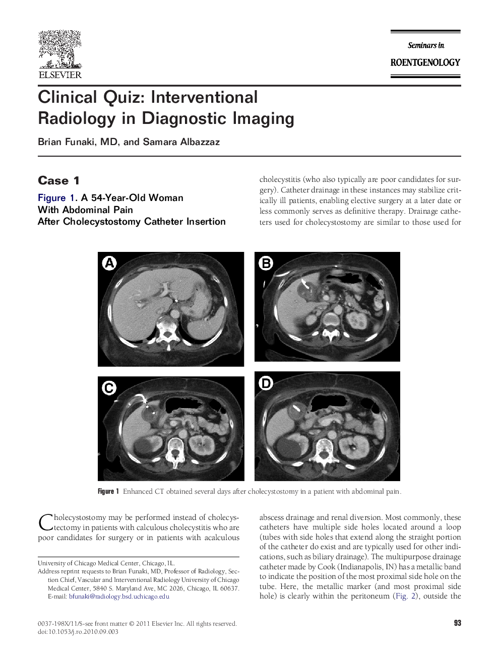 Clinical Quiz: Interventional Radiology in Diagnostic Imaging