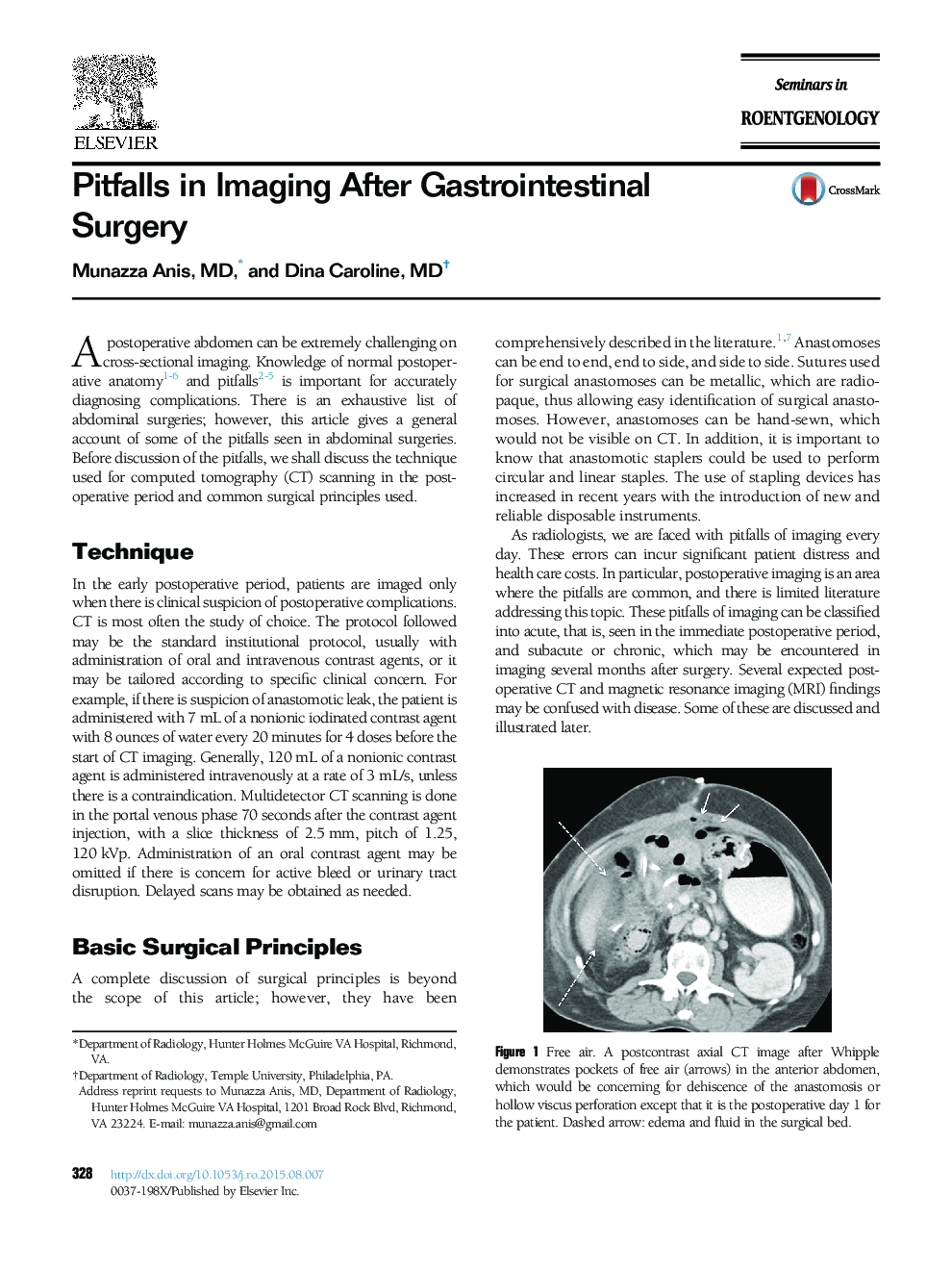 Pitfalls in Imaging After Gastrointestinal Surgery