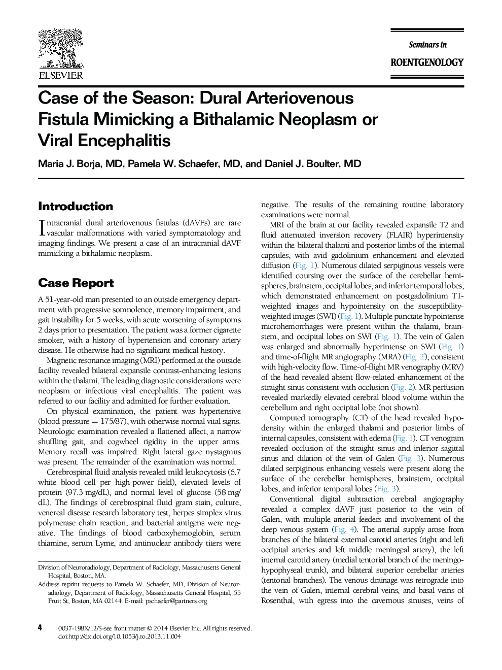 Case of the Season: Dural Arteriovenous Fistula Mimicking a Bithalamic Neoplasm or Viral Encephalitis