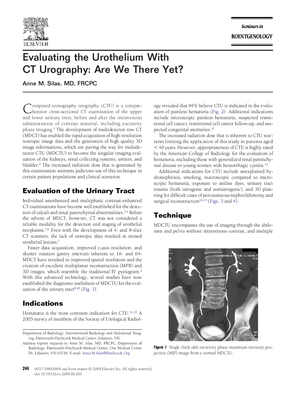 Evaluating the Urothelium With CT Urography: Are We There Yet?