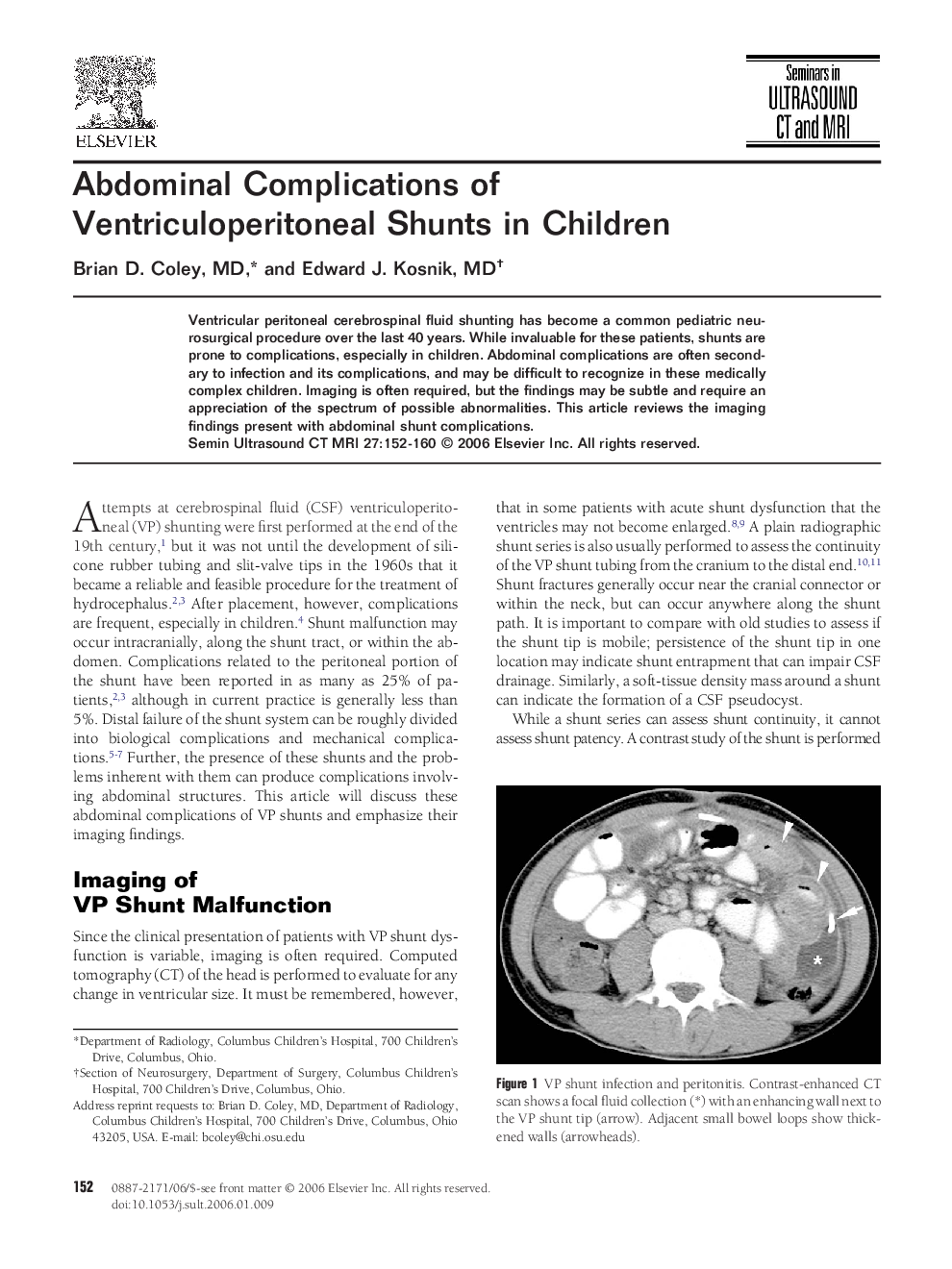 Abdominal Complications of Ventriculoperitoneal Shunts in Children