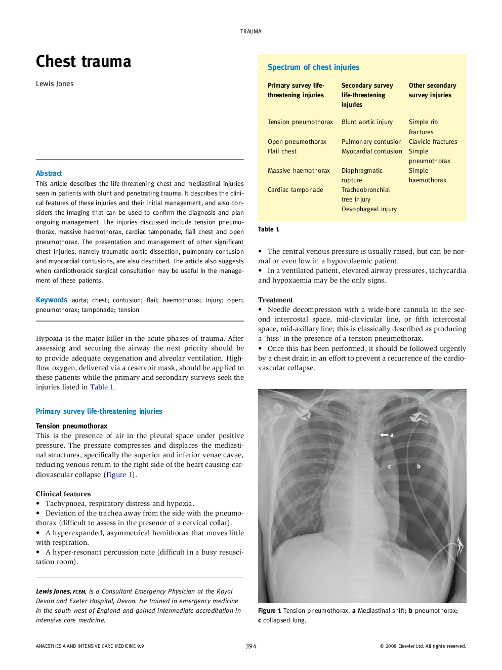 Chest trauma