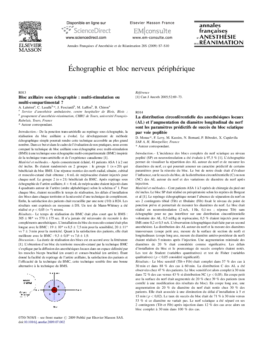 Echographie et bloc nerveux peripherique
