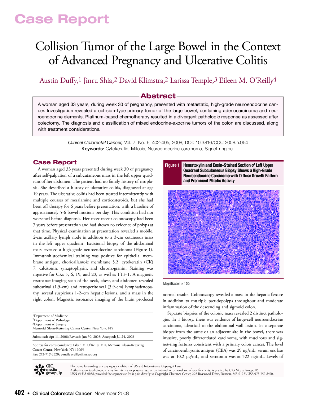 عکس صفحه اول مقاله: Collision Tumor of the Large Bowel in the Context of Advanced Pregnancy and Ulcerative Colitis Collision Tumor of the Large Bowel in the Context of Advanced Pregnancy and Ulcerative Colitis