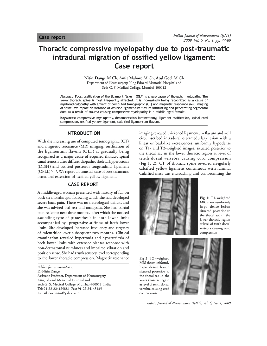 Thoracic compressive myelopathy due to post-traumatic intradural migration of ossified yellow ligament: Case report