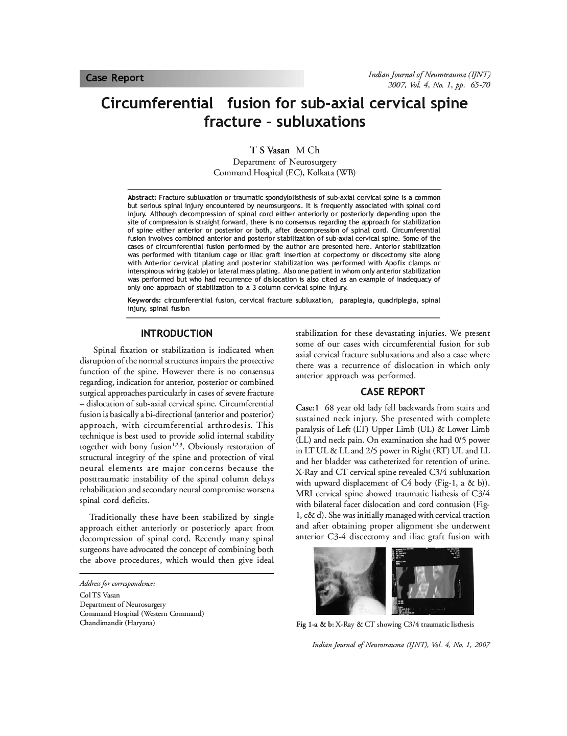 Circumferential fusion for sub-axial cervical spine fracture - subluxations