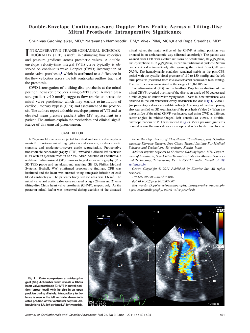Double-Envelope Continuous-wave Doppler Flow Profile Across a Tilting-Disc Mitral Prosthesis: Intraoperative Significance