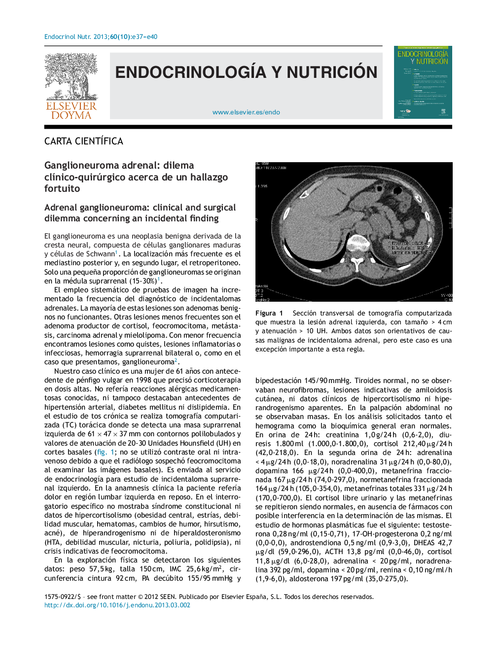 Ganglioneuroma adrenal: dilema clÃ­nico-quirúrgico acerca de un hallazgo fortuito