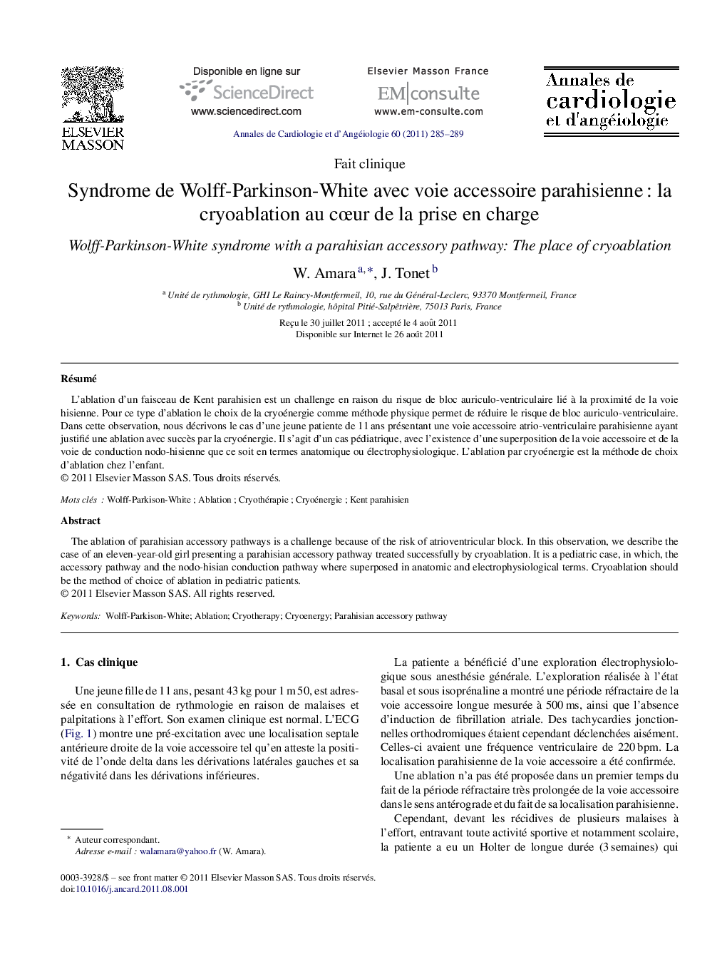 Syndrome de Wolff-Parkinson-White avec voie accessoire parahisienne : la cryoablation au cœur de la prise en charge