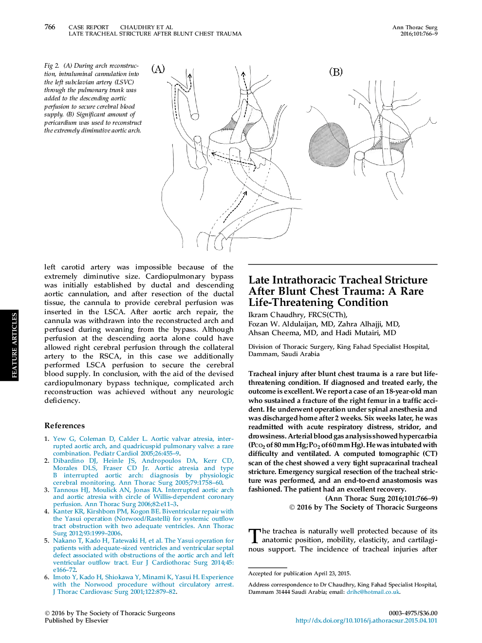 Late Intrathoracic Tracheal Stricture After Blunt Chest Trauma: A Rare Life-Threatening Condition