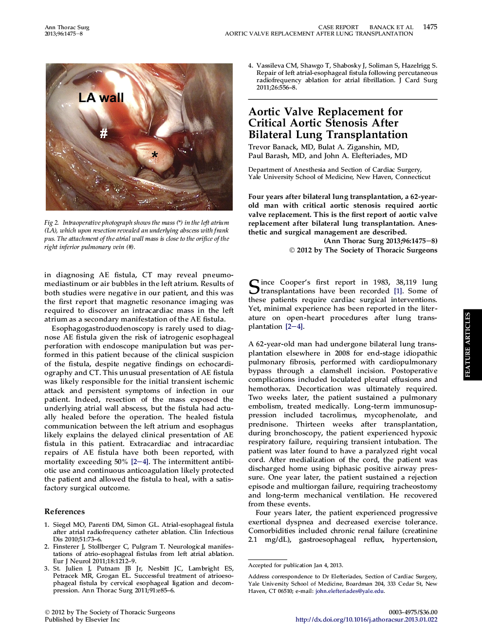 Aortic Valve Replacement for Critical Aortic Stenosis After Bilateral Lung Transplantation