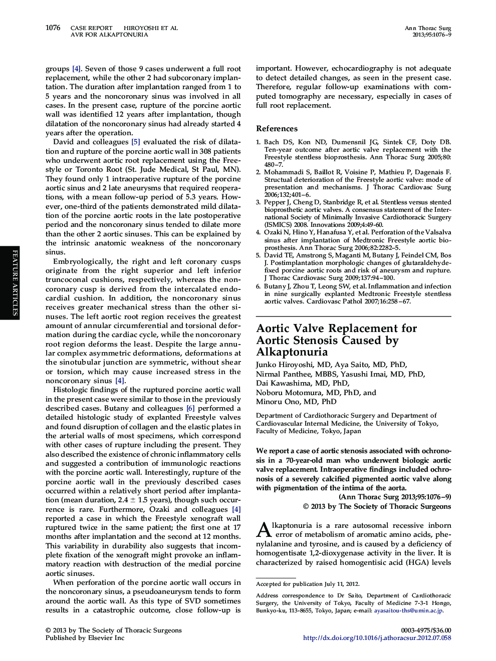 Aortic Valve Replacement for Aortic Stenosis Caused by Alkaptonuria
