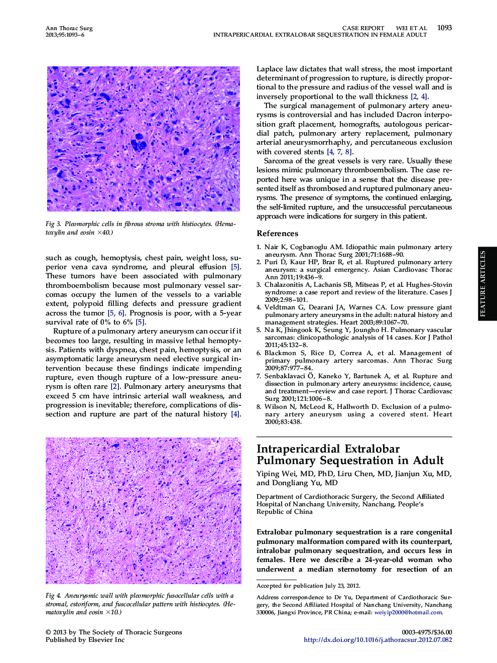 Intrapericardial Extralobar Pulmonary Sequestration in Adult