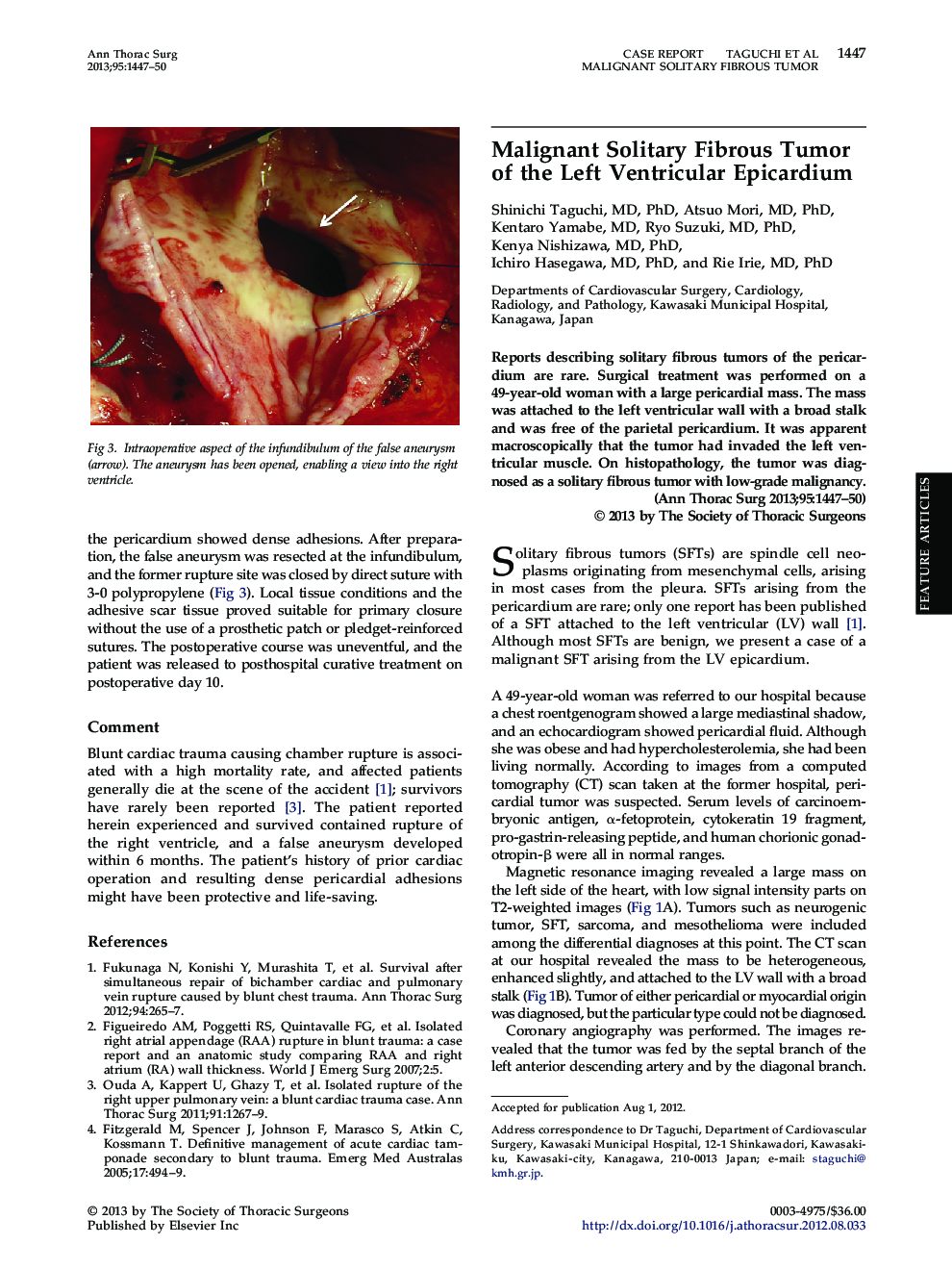 Malignant Solitary Fibrous Tumor of the Left Ventricular Epicardium