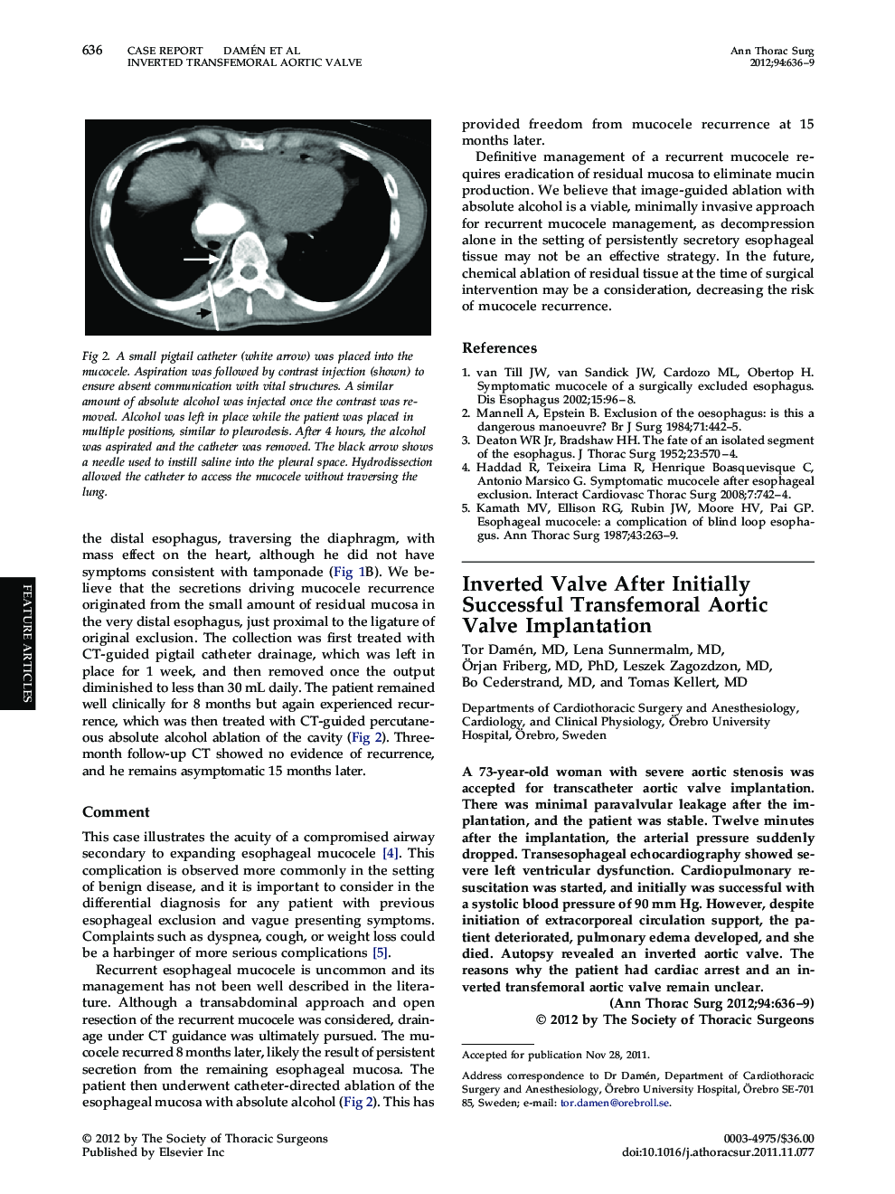 Inverted Valve After Initially Successful Transfemoral Aortic Valve Implantation